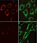 Immunofluorescent image of control HeLa cells (top) or KIF5B siRNA transfected HeLa cells (bottom) labeled with DSHB antibody SUK4 against KIF5B (red). Image Credit: J. Nylandsted. PMID: 19242560, 3A